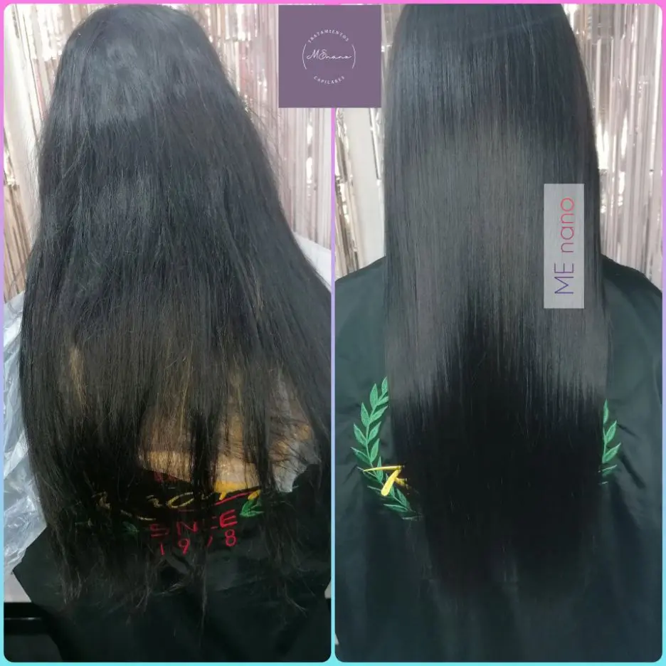 Antes y después con Nanoplastia Plus compartido por Estefania Flores